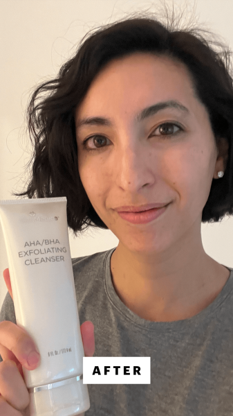 Pai after applying SkinMedica's AHA BHA Exfoliating Cleanser
